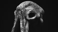 Prognostic jest podobna do Prognostic