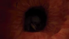 Revenge Of The Colon